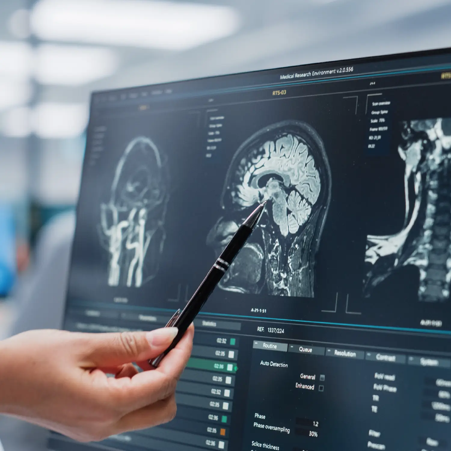 Imagerie médicale