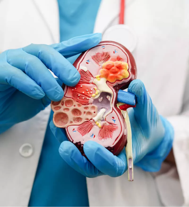 Prise en charge en urologie au Groupe ODM